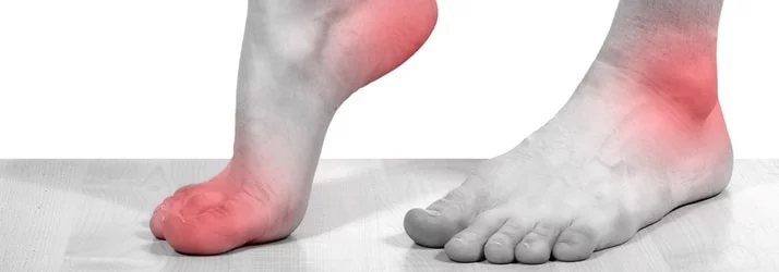 page - 1neuropathy foot pain